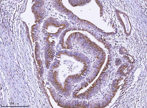  IHC analysis of ALDH3A1 using anti-ALDH3A1 antibody (A01121-5)