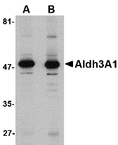 a01121 aldh3a1 primary antibodies wb testing 1