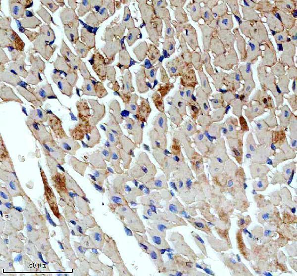 IHC analysis of SLN using anti-SLN antibody (A01122)