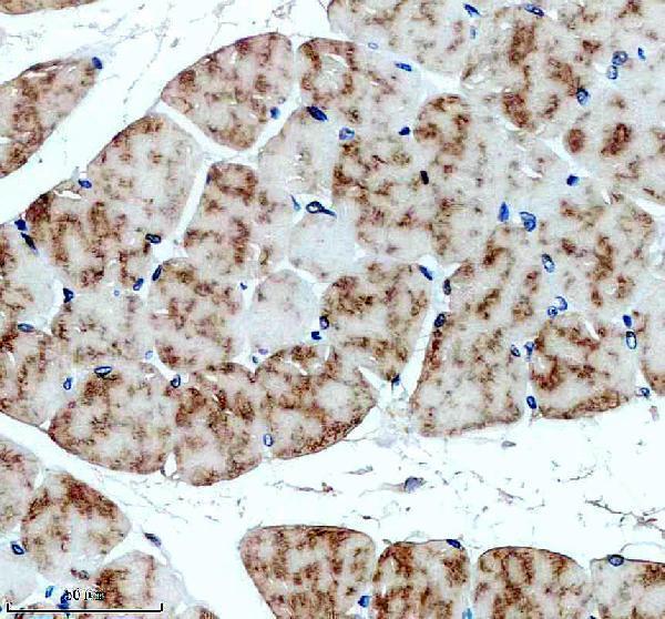 IHC analysis of SLN using anti-SLN antibody (A01122)