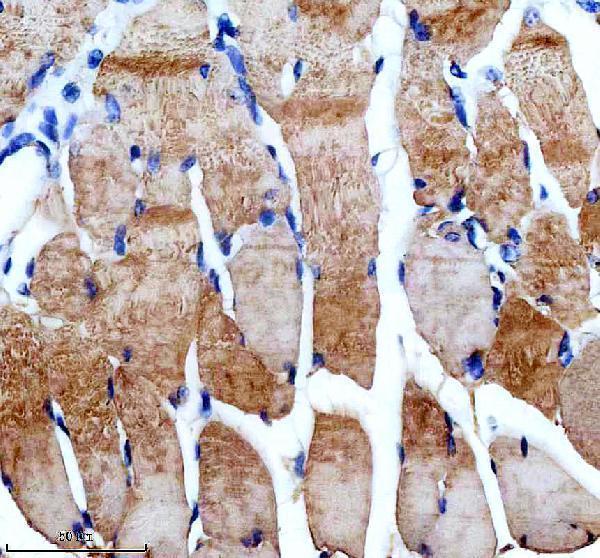 IHC analysis of SLN using anti-SLN antibody (A01122)