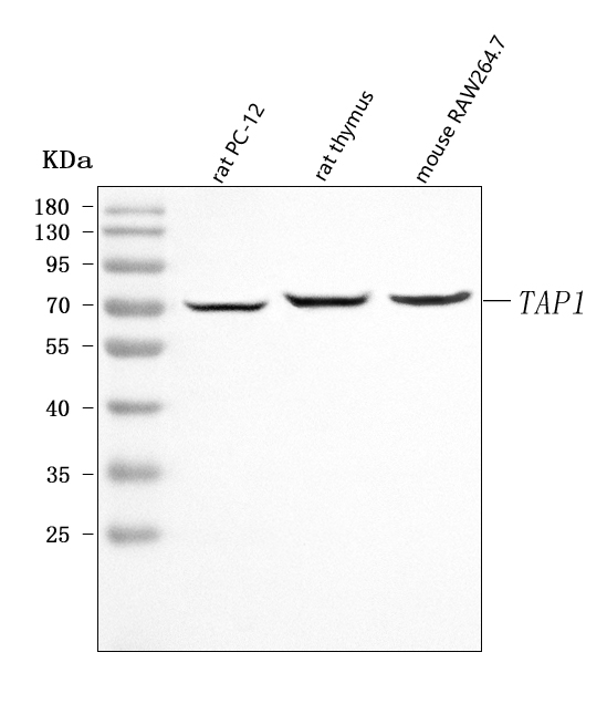  Western blot analysis of Tap1 using anti-Tap1 antibody (A01123-2)
