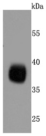 Western blot analysis of Podoplanin on human lung cells lysates using anti-Podoplanin antibody at 1/500 dilution
