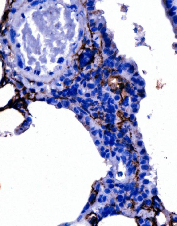 a01124 2 pdpn primary antibodies ihc testing 2