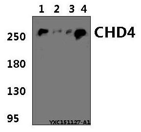 a01125 1 chd4 primary antiboties wb testing 1