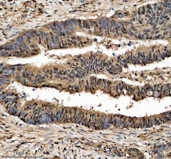 a01125 2 chd4 primary antibodies ihc testing 1