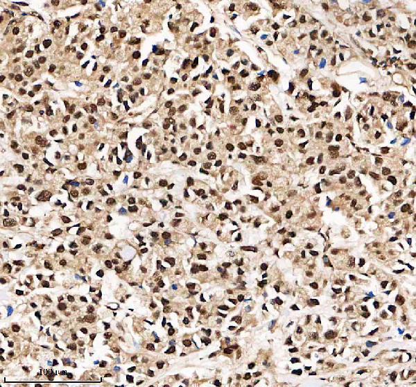 a01125 2 chd4 primary antibodies ihc testing 2