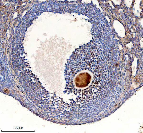 a01125 2 chd4 primary antibodies ihc testing 3
