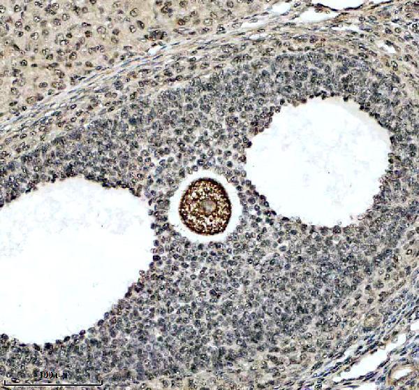 a01125 2 chd4 primary antibodies ihc testing 4