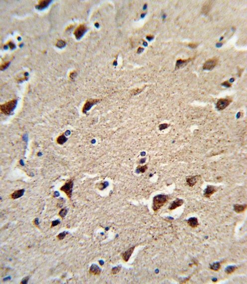 a01126 1 anti oat antibody n term ihc p testing 4