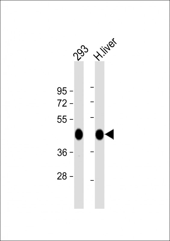 All lanes : Anti-OAT Antibody (N-term) at 1:1000 dilutionLane 1: 293 whole cell lysateLane 2: human liver lysateLysates/proteins at 20 µg per lane
