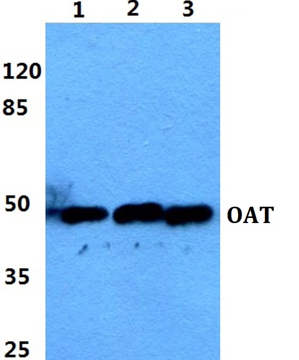 Western blot (WB) analysis of OAT polyclonal antibody at 1:500 dilution
Lane1:A549 cell lysate
Lane2:Raw264