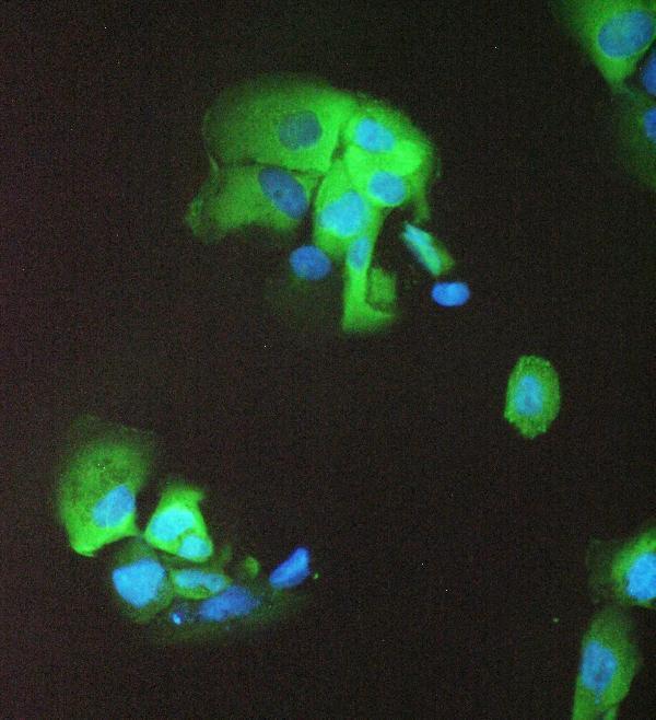  IF analysis of 14-3-3 sigma using anti-14-3-3 sigma antibody (A01127)