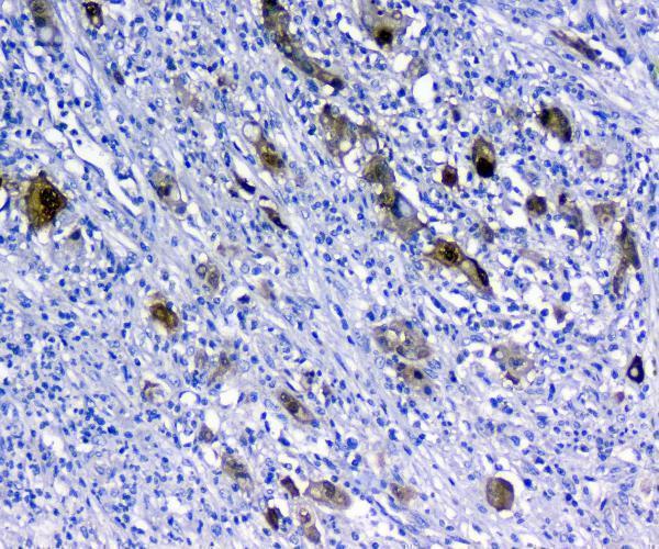  IHC analysis of 14-3-3 sigma using anti-14-3-3 sigma antibody (A01127)