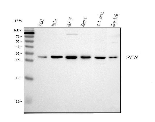 Western blot analysis of 14-3-3 sigma using anti-14-3-3 sigma antibody (A01127).