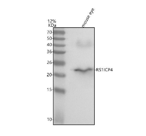 a01128 rs1 primary antibodies wb testing 1