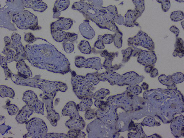 a01129 2 nrf1 primary antibodies ihc testing 10