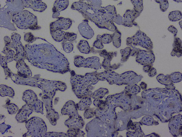 IHC analysis of NRF1 using anti-NRF1 antibody (A01129-2). NRF1 was detected in paraffin-embedded section of human placenta tissue. Heat mediated antigen retrieval was performed in citrate buffer (pH6, epitope retrieval solution) for 20 mins. The tissue section was blocked with 10% goat serum. The tissue section was then incubated with 1μg/ml rabbit anti-NRF1 Antibody (A01129-2) overnight at 4°C. Biotinylated goat anti-rabbit IgG was used as secondary antibody and incubated for 30 minutes at 37°C. The tissue section was developed using Strepavidin-Biotin-Complex (SABC)(Catalog # SA1022) with DAB as the chromogen.