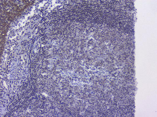 a01129 2 nrf1 primary antibodies ihc testing 11