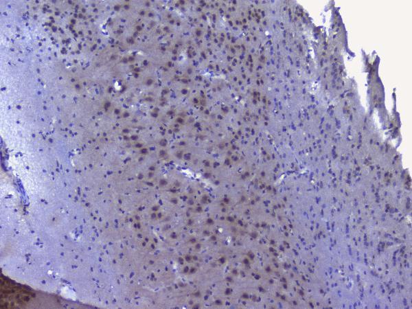 a01129 2 nrf1 primary antibodies ihc testing 14