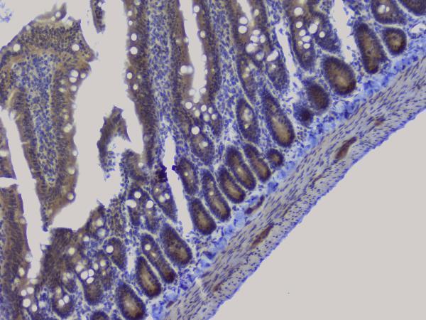 a01129 2 nrf1 primary antibodies ihc testing 15