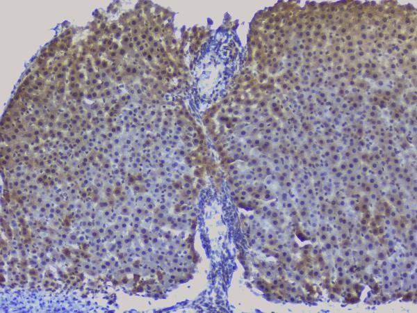 a01129 2 nrf1 primary antibodies ihc testing 16