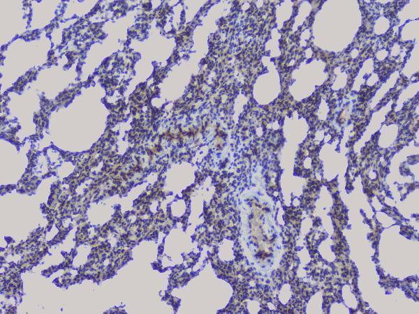 a01129 2 nrf1 primary antibodies ihc testing 17