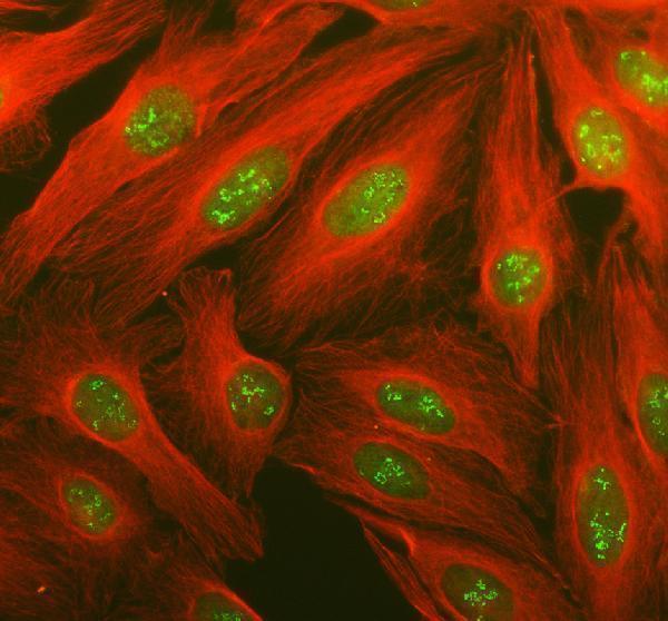 IF analysis of PBRM1 using anti-PBRM1 antibody (A01130-1) and anti-Alpha Tubulin antibody (M03989-3)