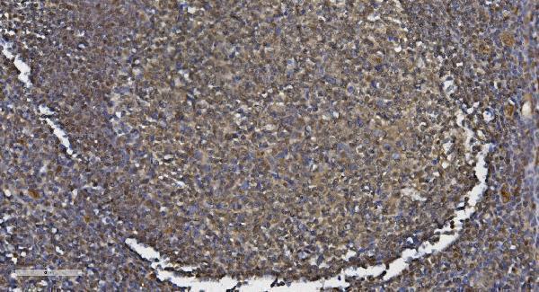 a01131 1 mef2c primary antibodies ihc testing 2