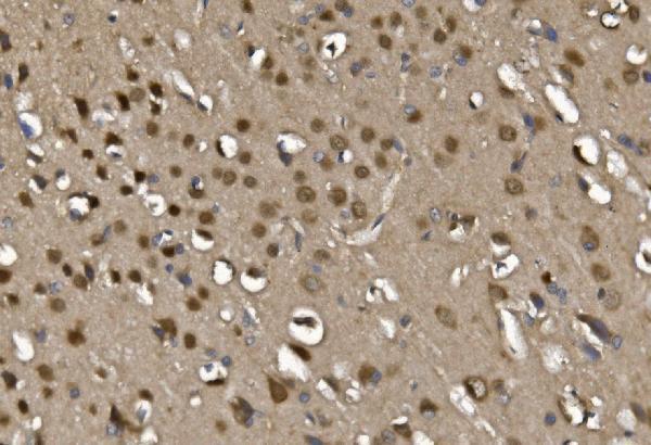 a01131 1 mef2c primary antibodies ihc testing 3
