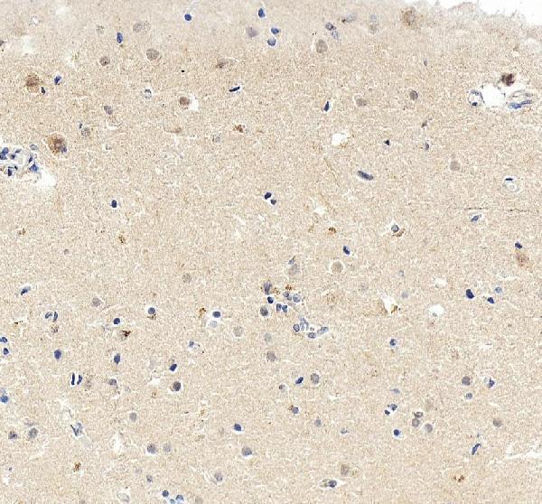 a01131 1 mef2c primary antibodies ihc testing 5