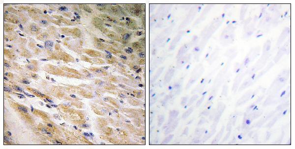 Immunohistochemistry analysis of paraffin-embedded human heart, using MEF2C (Phospho-Ser387) Antibody