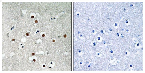 a01131s396 1 mef2c primary antibodies ihc testing 1