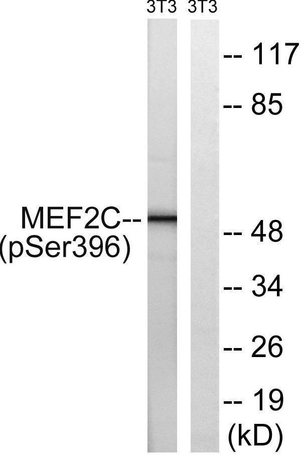 a01131s396 1 mef2c primary antibodies wb testing 2