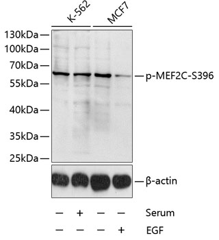 Western blot analysis of extracts of K-562 and MCF-7 cells, using Phospho-MEF2C-S396 antibody  at 1:1000 dilution