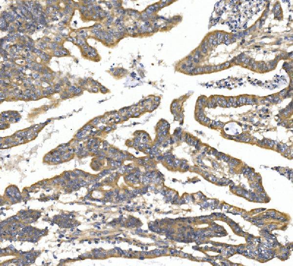 a01132 1 ttk primary antibodies ihc testing 2