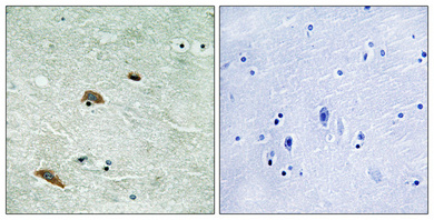 Immunohistochemical analysis of paraffin-embedded Human brain