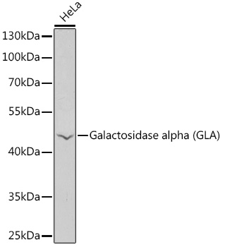 Western blot analysis of extracts of HeLa cells, using Galactosidase alpha ) antibody  at 1:1000 dilution