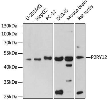 a01136 p2ry12 primary antiboties wb testing 1