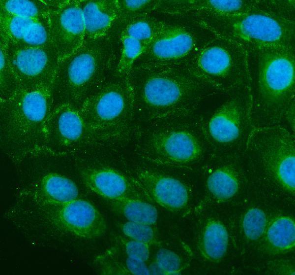 IF analysis of SCN4A using anti-SCN4A antibody (A01138-2)