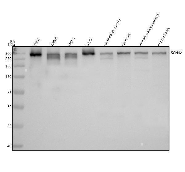 Western blot analysis of SCN4A using anti-SCN4A antibody (A01138-2)