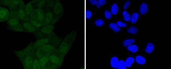 ICC staining Phospho-IKB alpha(S32) in Hela cells (green)