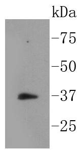 Western blot analysis of Phospho-IKB alpha(S32) on Ags cell lysates using anti-Phospho-IKB alpha(S32) antibody at 1/1,000 dilution