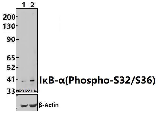 Western blot (WB) analysis of IκB-α(Phospho-S32/S36) polyclonal antibody at 1:200 dilution
Lane1:THP-1 whole cell lysate(30ug)
Lane2:THP-1 treated with PMA(200nM, 30min) whole cell lysate(30ug)