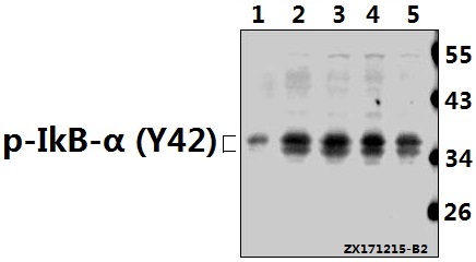 Western blot (WB) analysis of p-IkB-α (Y42) pAb at 1:500 dilution
Lane1:The Brain tissue lysate of Mouse(40ug)
Lane2:SGC7901 whole cell lysate(40ug)
Lane3:HCT116 whole cell lysate(40ug)
Lane4:MCF-7 whole cell lysate(40ug)
Lane5:Beas-2B whole cell lysate(40ug)