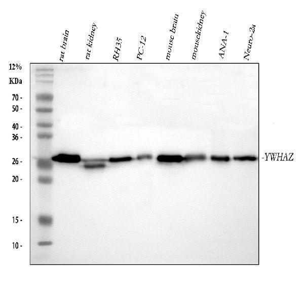  Western blot analysis of 14-3-3 zeta/delta using anti-14-3-3 zeta/delta antibody (A01141-1)