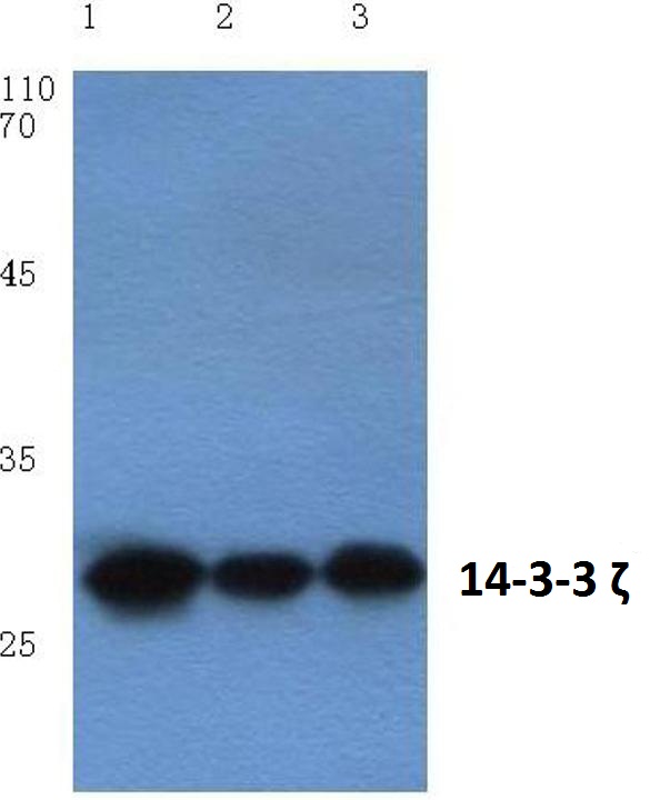 Western blot (WB) analysis of 14-3-3 ζ (V52) polyclonal antibody at 1:500 dilution
Lane1:Hela cell lysate
Lane2:Mouse brain tissue lysate
Lane3:Rat kidney tissue lysate