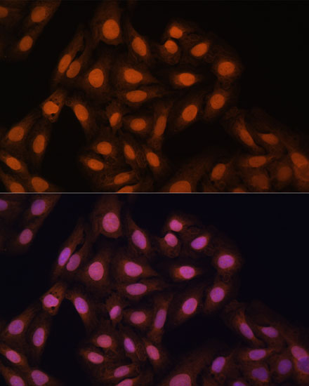 a01142 1 cbx3 primary antiboties if testing 4
