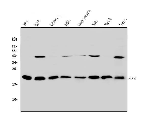  Western blot analysis of HP1 gamma using anti-HP1 gamma antibody (A01142)