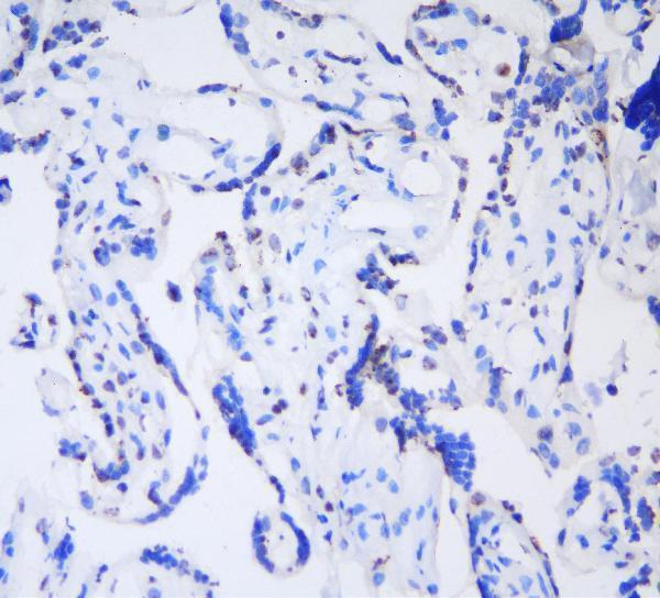 a01142 hp1_gamma primary antibodies ihc f testing 10